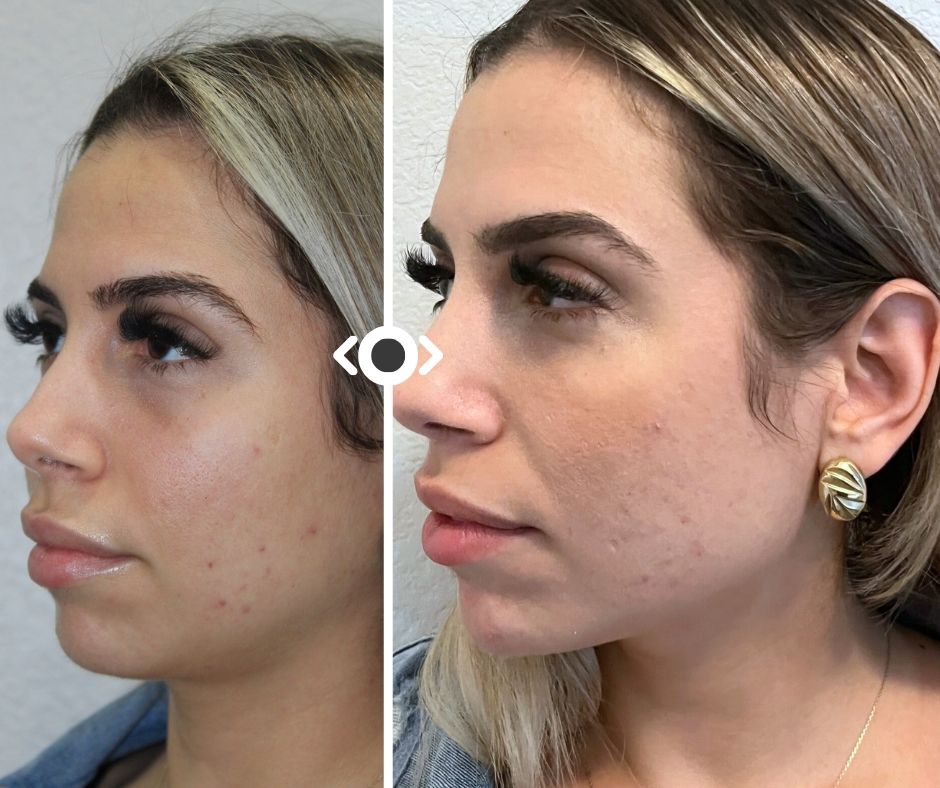 Facial Balancing