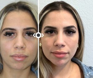 Facial Balancing