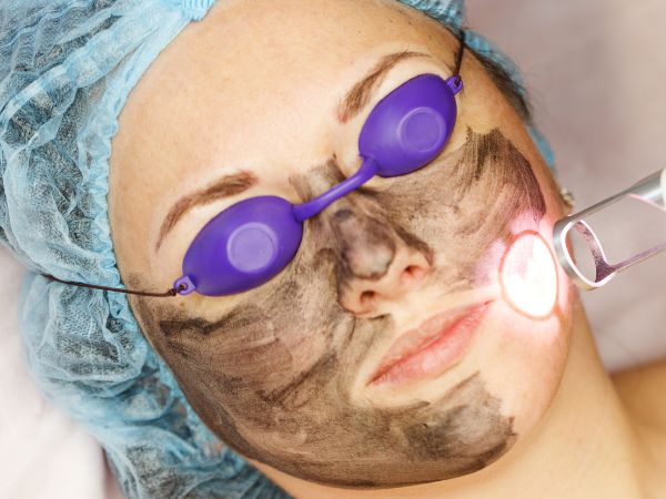 Lip Filler