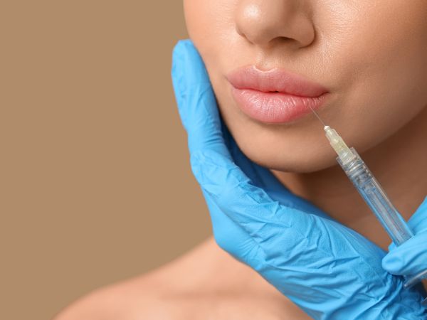 Lip Filler
