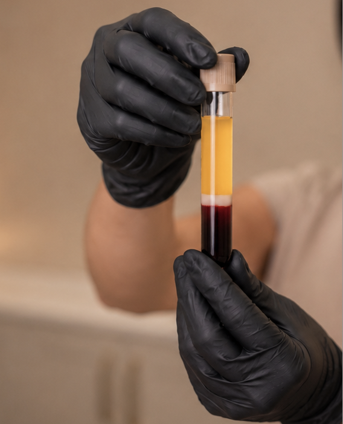 PRP